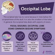 Occipital Epilepsy Essay Example