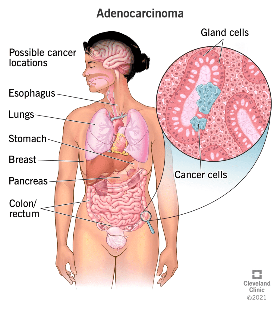 Current Topics in Cancer Research 