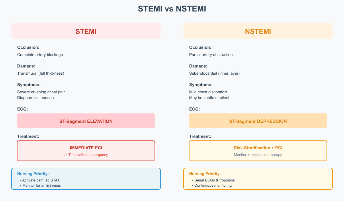 STEMI vs NSTEMI