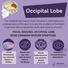 Occipital epilepsy essay example