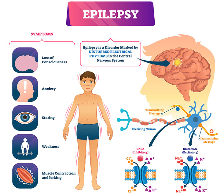 50+ Hot Epilepsy Topics + 2 Best Sample Papers