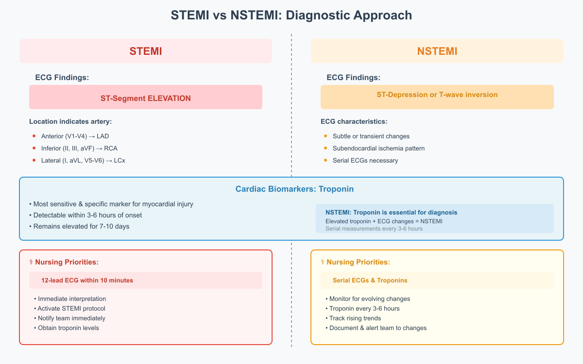STEMI vs NSTEMI